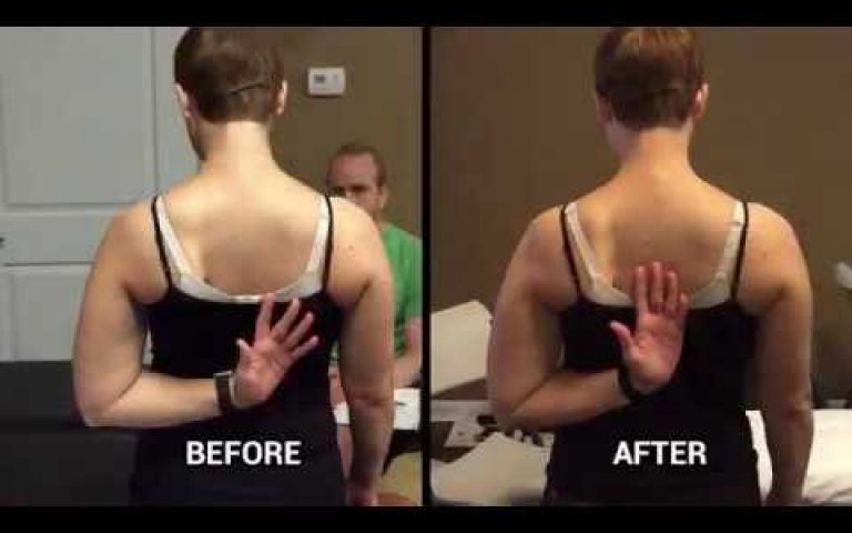 internal rotation shoulder