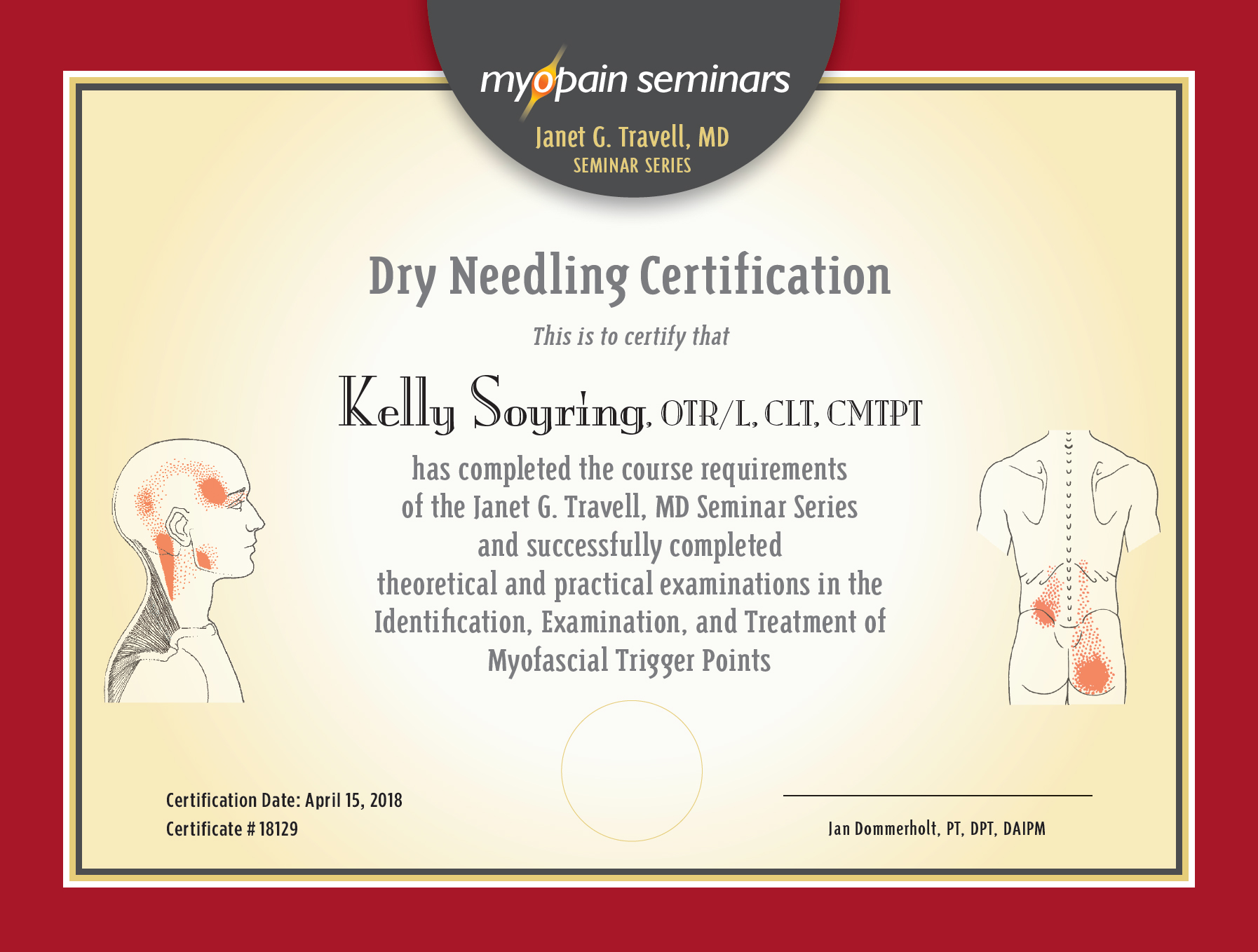 Dry Needling by Occupational Therapists Myopain Seminars