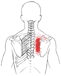 serratus posterior trigger point